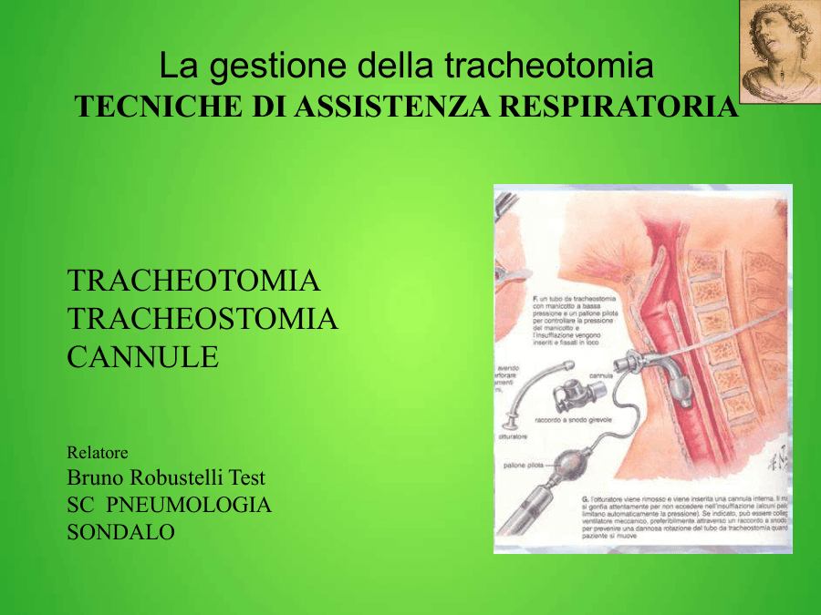 Gestione della Tracheotomia e Tecniche di Assistenza Respiratoria